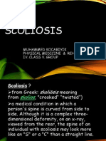 Scoliosis .pptx