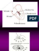 Ekg 1