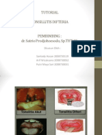 TUTORIAL Tonsilitis Difteria