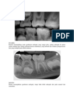 Tugas Responsi Radiology