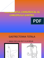 Curs 5 - Tratamentul Chirurgical Al Cancerului Gastric