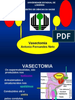 Vasectomia