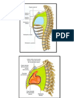 Tumor Mediastinal