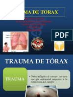 Trauma de Torax