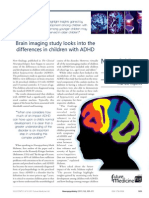 Brain Imaging Study Looks Into The Differences in Children With ADHD