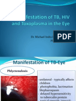 Toxoplasmosis (Dr. Michael)