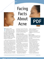 Acne Facts0112