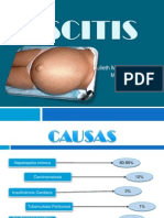 Ascitis Diapositivas