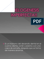 Amelogenesis Imperfecta!!
