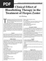 Treatment of Herpes Zoster