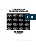 Anatomia Radiológica - Tomografia de Abdome - Axial