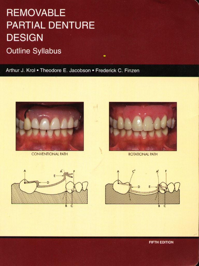 Krol, Removable Partial Denture DesignOutline Syllabus PDF