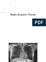 Radio-Anatomi Thorax Dikiduha