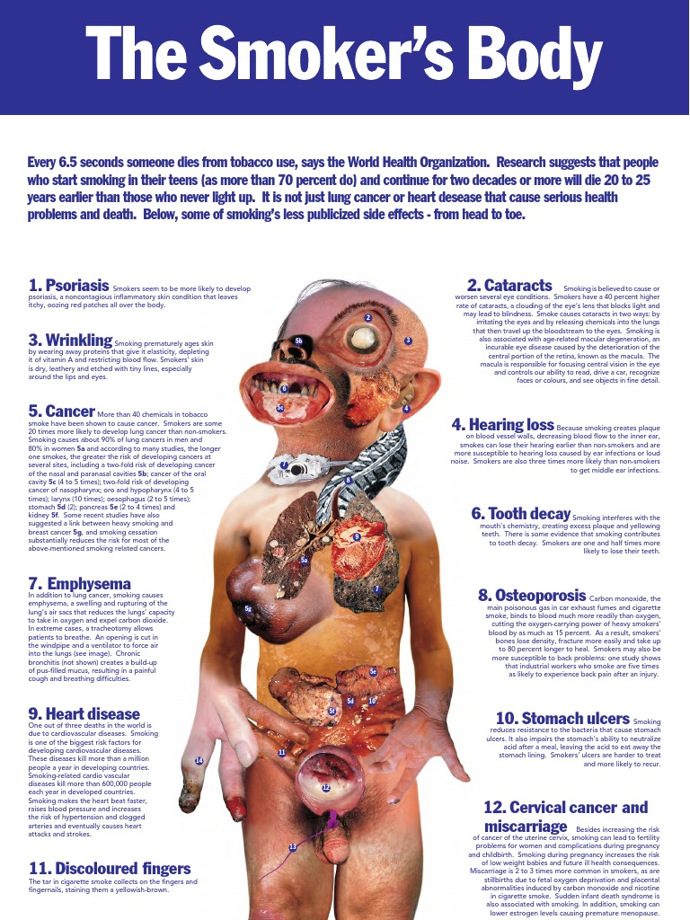 Effects of Smoking on the Body | PDF | Human Eye