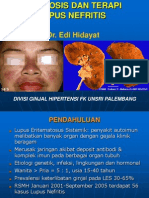 Diagnosis Lupus Nefritis, Dr. Edi Hidayat