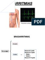 BRADICARDIA