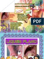 Patologia _liquen Plano