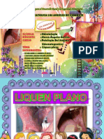Liquen Plano Exposicion PDF