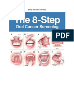 8 Steps Oral Cancer Screening