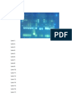 Gel Electrophoresis