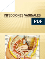 Infecciones Vaginales