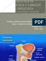 2- Hipertrofia Prostatica y CA de Prostata