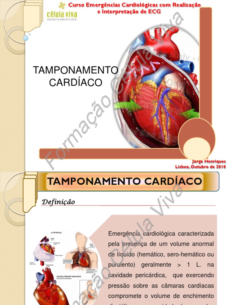 Tamponamento Cardíaco | PDF | Coração | Sistema circulatório
