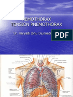 HEMATOTHORAX