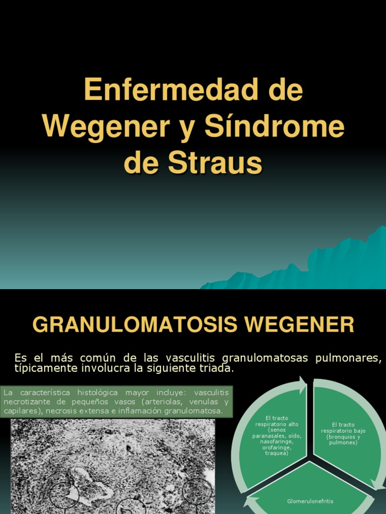 Enfermedad de Wegener Y... | PDF
