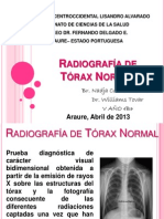 Radiografía de Tórax Normal