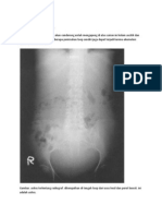 Translate Abdominal X-rays Made Easy