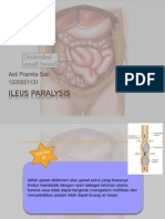 Ileus Paralysis