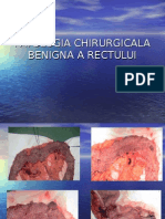 Patologie Rect - Benign