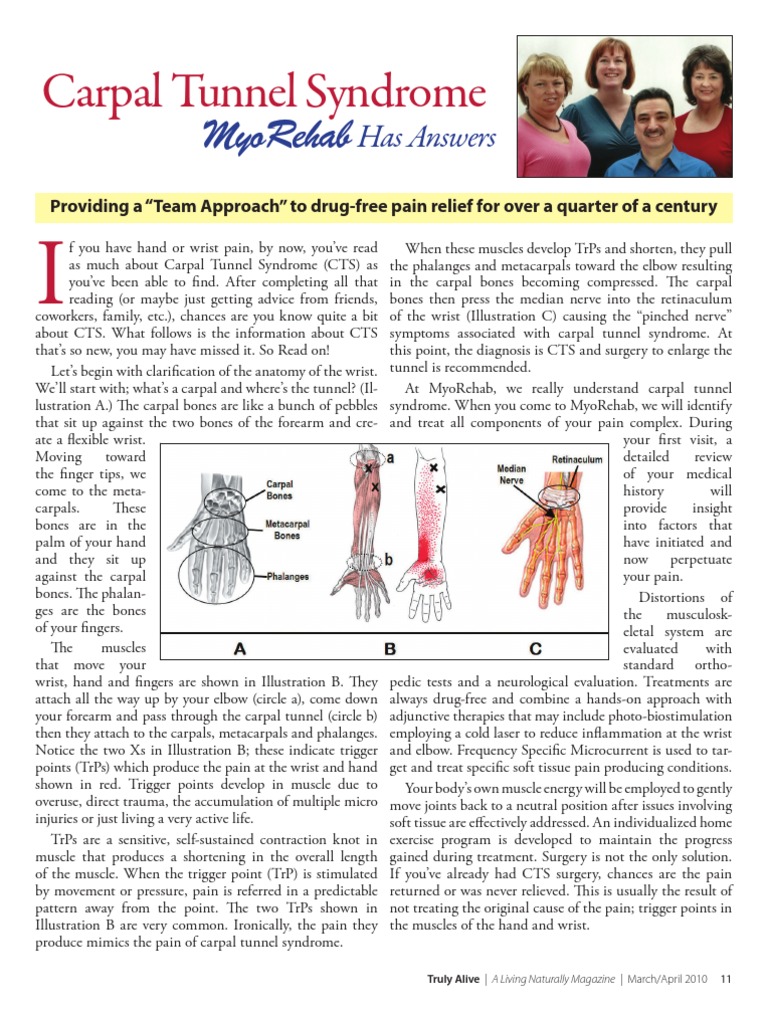Carpal Tunnel Syndrome | PDF | Hand | Carpal Tunnel Syndrome