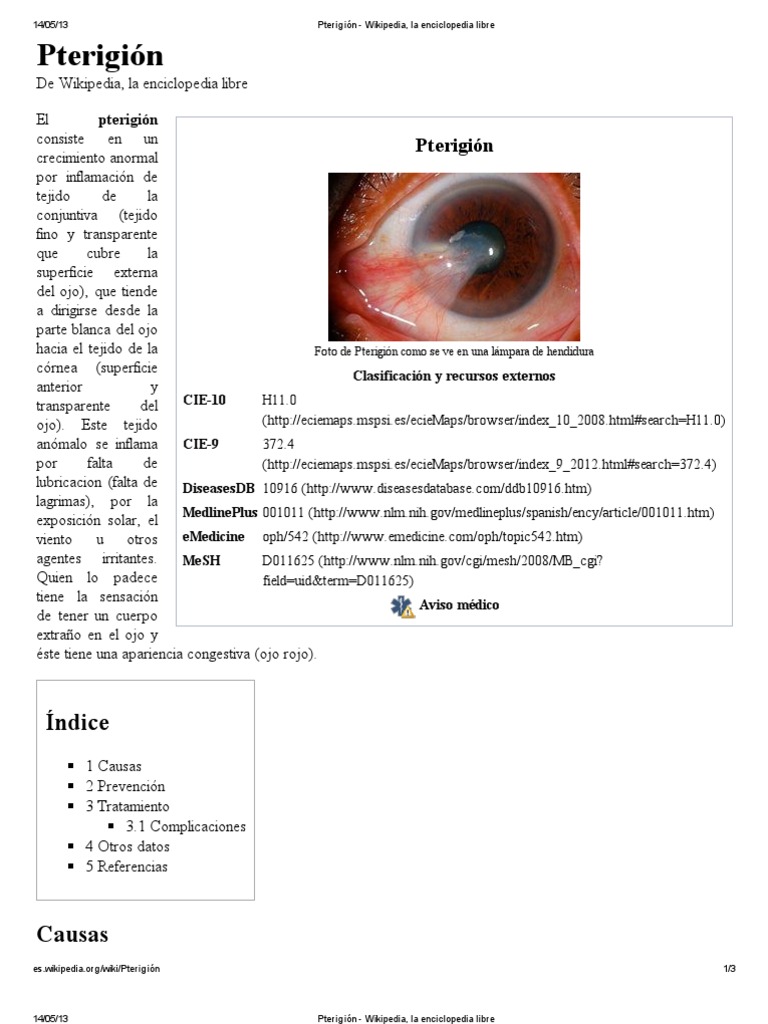 Que Son Cataratas En Los Ojos Wikipedia Consejos Ojos