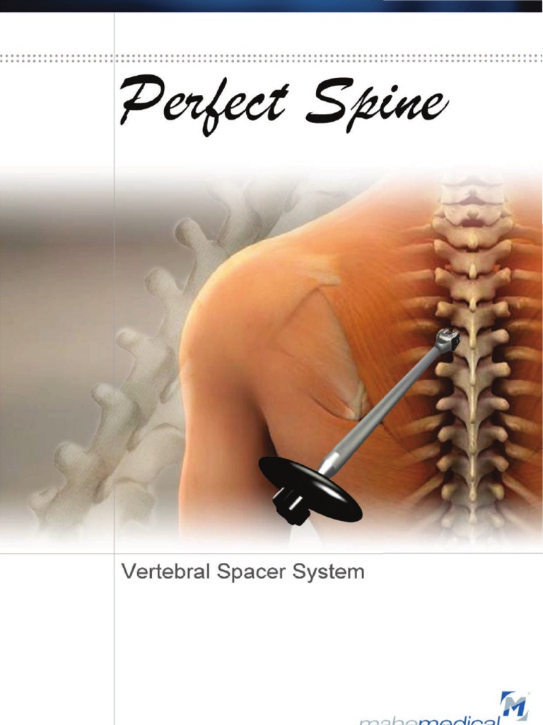 Cages Interbody Spacer System Coluna Vertebral Vértebra