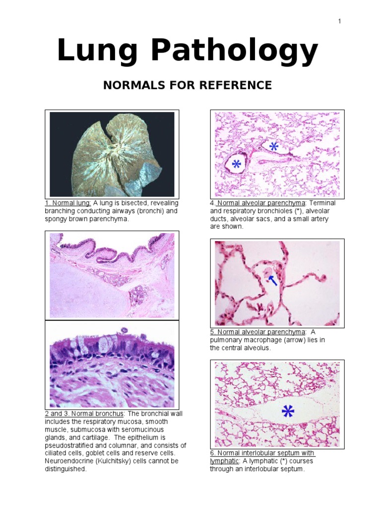 Lung Pathology: Atelectasis & Edema Insights | PDF | Pneumonia ...