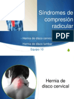 Sindromedecompresionradicular 120422152929 Phpapp02