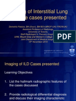 ADR Radiographic Pearls in ILD