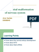 Congenital Malformation of Nervous System PPT Sesi 1
