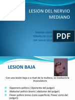 Lesion Del Nervio Mediano y Cubital