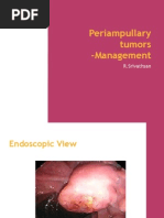 Periampullary Carcinoma