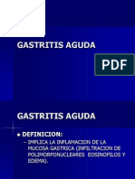 GASTRITIS AGUDA Y CRÓNICA DONE