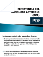 Persistencia del conducto arterioso