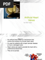 Artificial Heart Valves: By: Brian Volpe