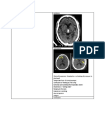 Ct Scan Brain