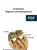 Arrhythmia