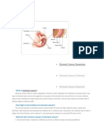 Stomach Cancer Symptoms