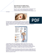 Cómo Detectar Las Señales de Un AVC