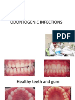 Odontogenic Infections
